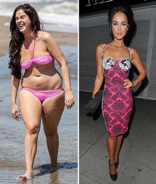 photo avant et après une perte de poids